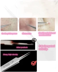 🔥Professional Facial Blackhead Remover Tweezers