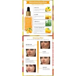 Vitamin C Whitening Serum Brighten