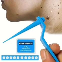 Skin Tag Killer Mole Wart Remover