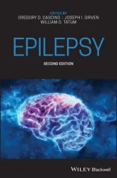 Epilepsy