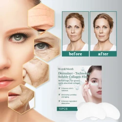 Collagen Membrane Nourishing And Firming Skin Lightens Wrinkles